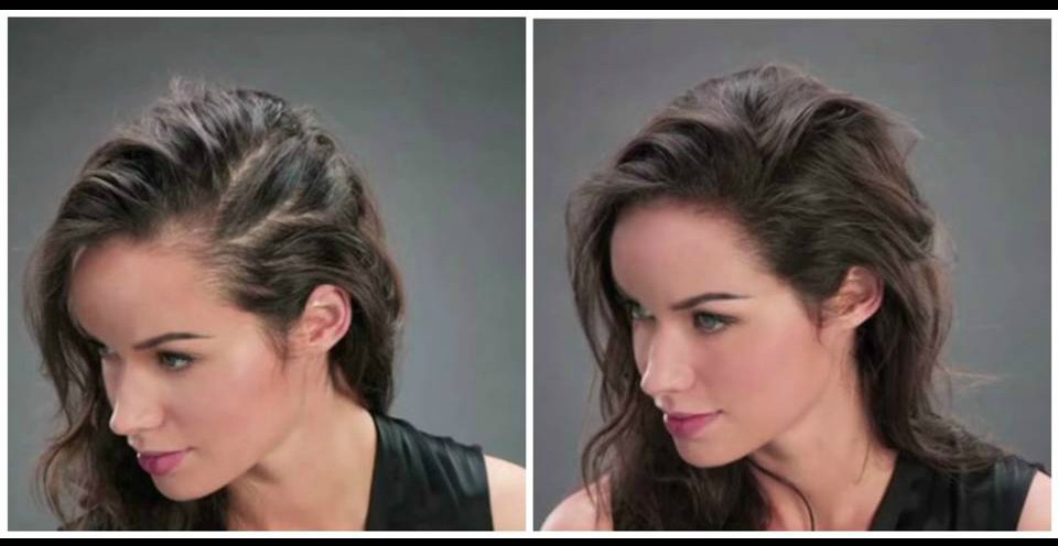 κάλυψη αραίωσης με ίνες πύκνωσης